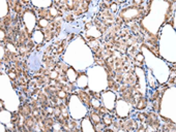 MORC2 Antibody in Immunohistochemistry (Paraffin) (IHC (P))