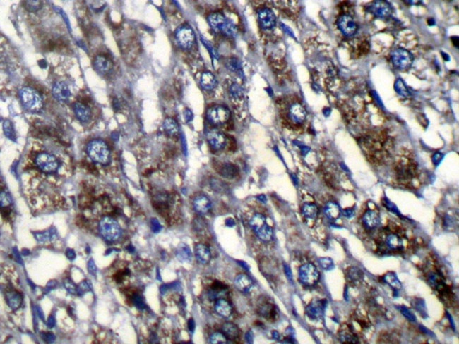 ZFAND3 Antibody in Immunohistochemistry (Paraffin) (IHC (P))