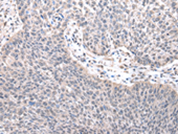 ZNF239 Antibody in Immunohistochemistry (Paraffin) (IHC (P))