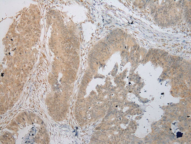 TIGD5 Antibody in Immunohistochemistry (Paraffin) (IHC (P))
