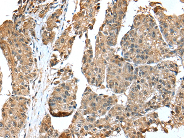 EML4 Antibody in Immunohistochemistry (Paraffin) (IHC (P))