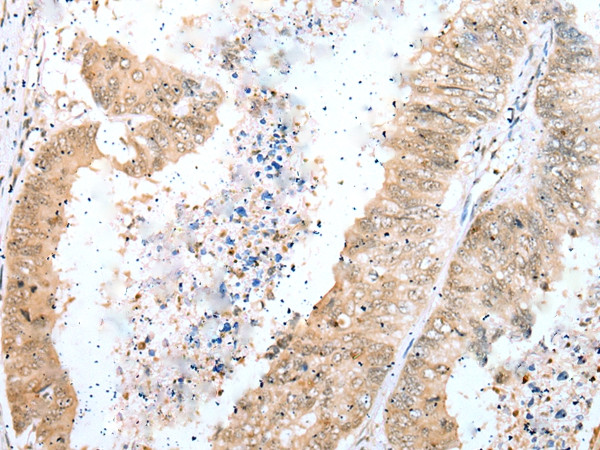 DTWD1 Antibody in Immunohistochemistry (Paraffin) (IHC (P))