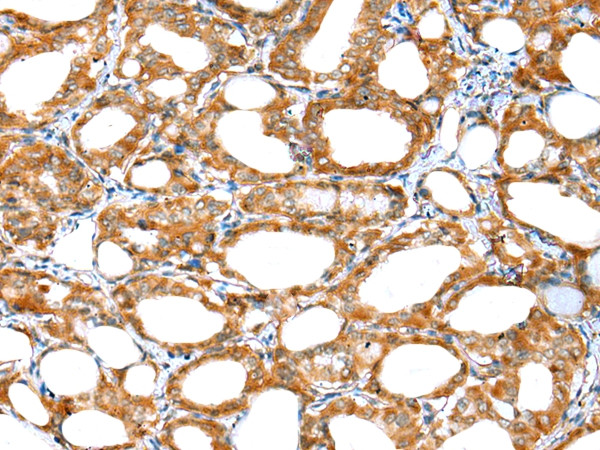 ERMP1 Antibody in Immunohistochemistry (Paraffin) (IHC (P))