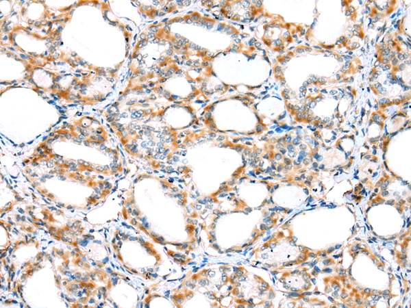 MYBPHL Antibody in Immunohistochemistry (Paraffin) (IHC (P))