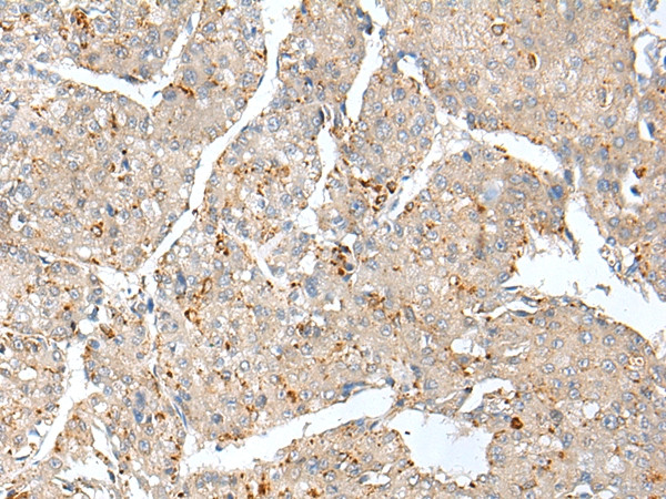 THEM5 Antibody in Immunohistochemistry (Paraffin) (IHC (P))