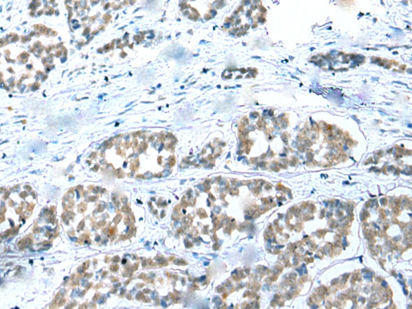 COMMD6 Antibody in Immunohistochemistry (Paraffin) (IHC (P))