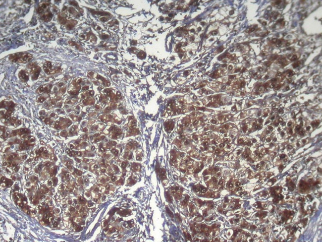 RPS15 Antibody in Immunohistochemistry (Paraffin) (IHC (P))