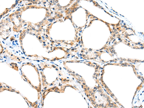 SPACA3 Antibody in Immunohistochemistry (Paraffin) (IHC (P))