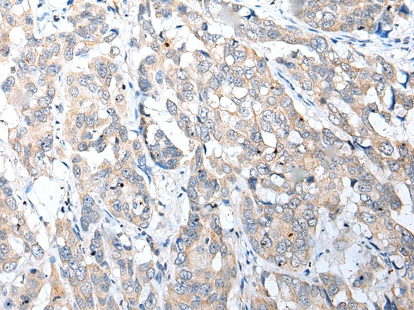 NUDT22 Antibody in Immunohistochemistry (Paraffin) (IHC (P))