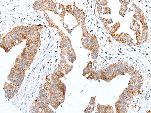 RhoV Antibody in Immunohistochemistry (Paraffin) (IHC (P))