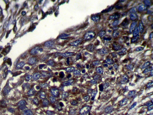 CAPS2 Antibody in Immunohistochemistry (Paraffin) (IHC (P))
