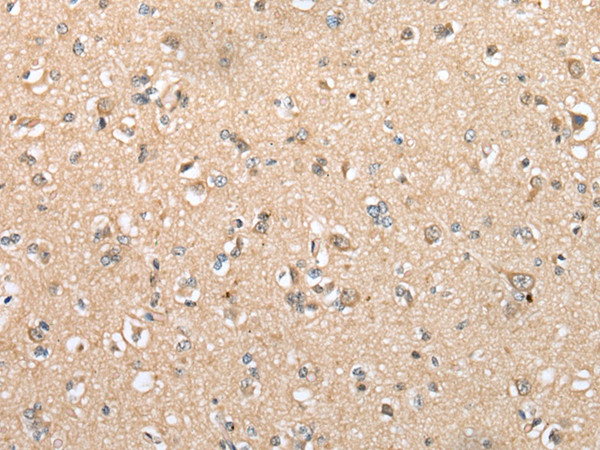 DYDC2 Antibody in Immunohistochemistry (Paraffin) (IHC (P))
