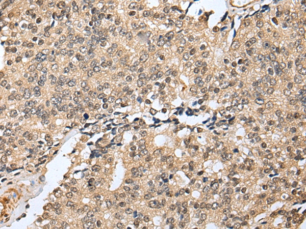 RHEBL1 Antibody in Immunohistochemistry (Paraffin) (IHC (P))