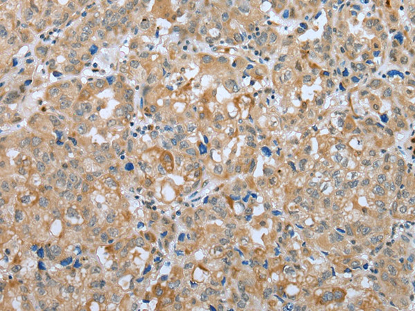 PLA2G4D Antibody in Immunohistochemistry (Paraffin) (IHC (P))