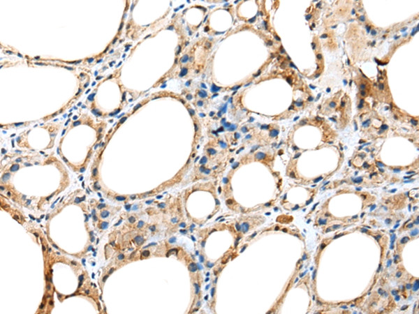 HEATR2 Antibody in Immunohistochemistry (Paraffin) (IHC (P))