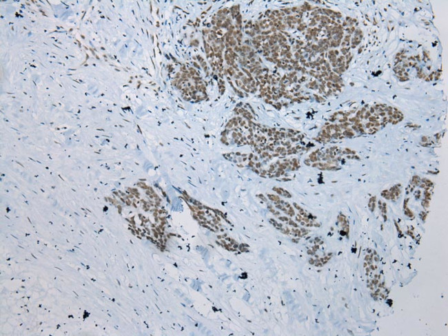ZNF22 Antibody in Immunohistochemistry (Paraffin) (IHC (P))