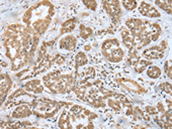 MOB4 Antibody in Immunohistochemistry (Paraffin) (IHC (P))