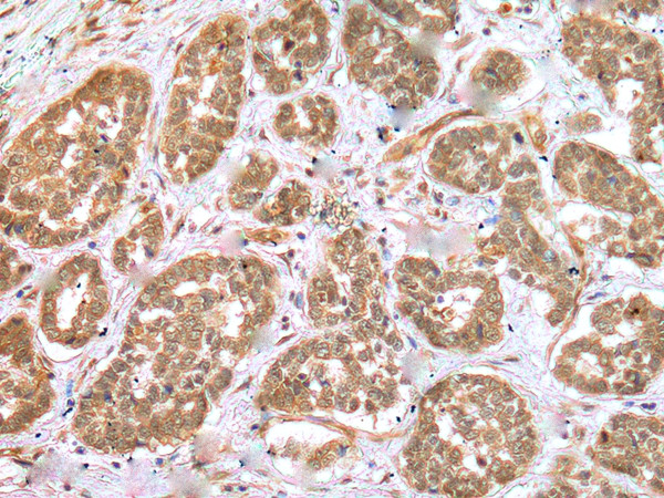 ZNF313 Antibody in Immunohistochemistry (Paraffin) (IHC (P))