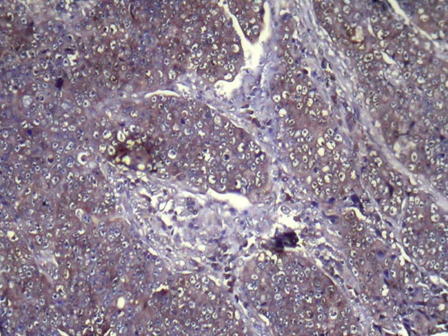 GLIPR1L1 Antibody in Immunohistochemistry (Paraffin) (IHC (P))