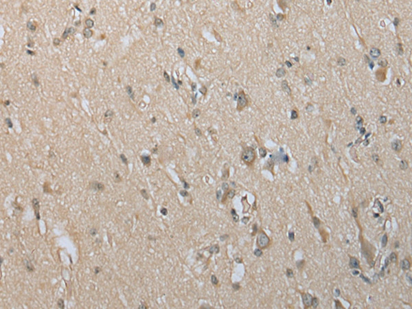 DECR2 Antibody in Immunohistochemistry (Paraffin) (IHC (P))