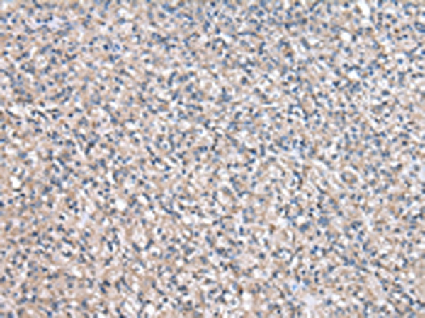 NPC2 Antibody in Immunohistochemistry (Paraffin) (IHC (P))