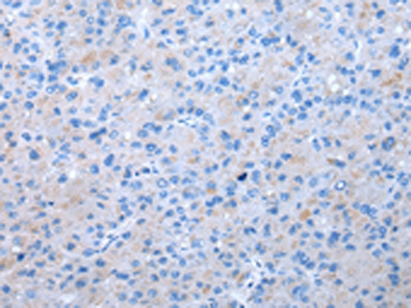 eIF3i Antibody in Immunohistochemistry (Paraffin) (IHC (P))