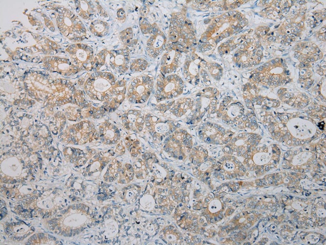 HGD Antibody in Immunohistochemistry (Paraffin) (IHC (P))