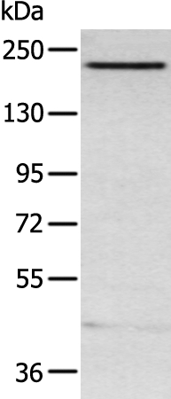 ARID2 Antibody in Western Blot (WB)