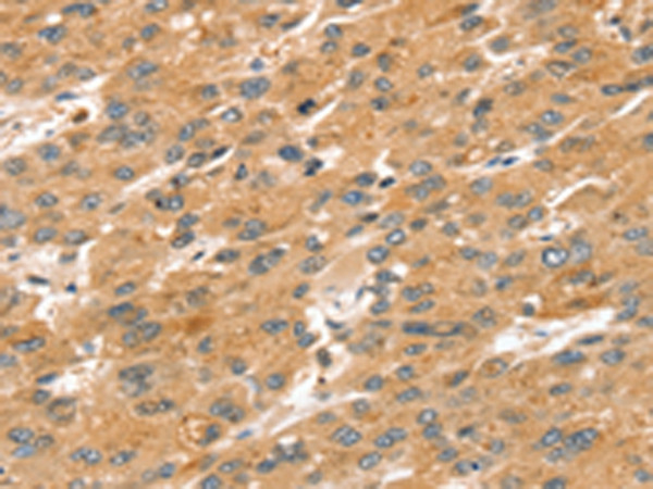 SPATA18 Antibody in Immunohistochemistry (Paraffin) (IHC (P))