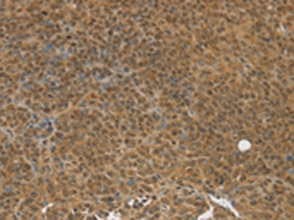 TGM7 Antibody in Immunohistochemistry (Paraffin) (IHC (P))