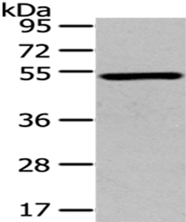 TSPYL1 Antibody in Western Blot (WB)