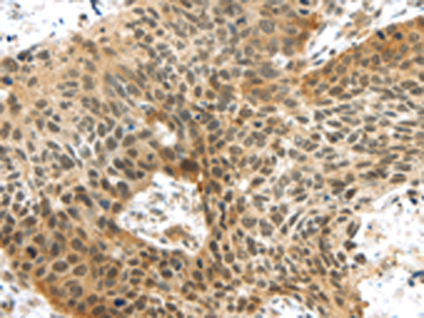TTBK2 Antibody in Immunohistochemistry (Paraffin) (IHC (P))