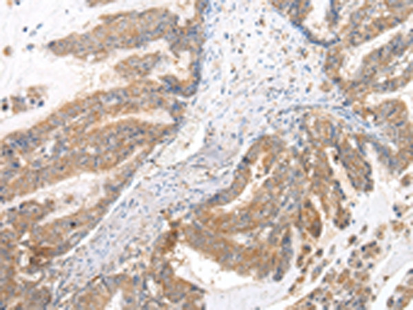XKRX Antibody in Immunohistochemistry (Paraffin) (IHC (P))