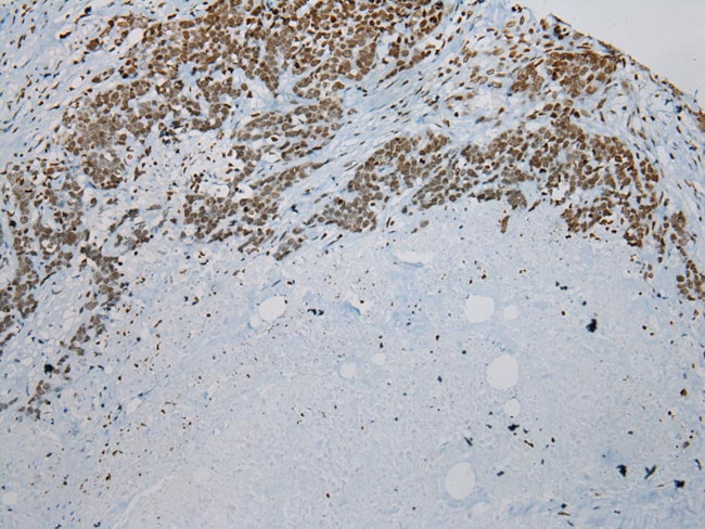 ZNF200 Antibody in Immunohistochemistry (Paraffin) (IHC (P))