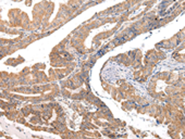 COL8A2 Antibody in Immunohistochemistry (Paraffin) (IHC (P))