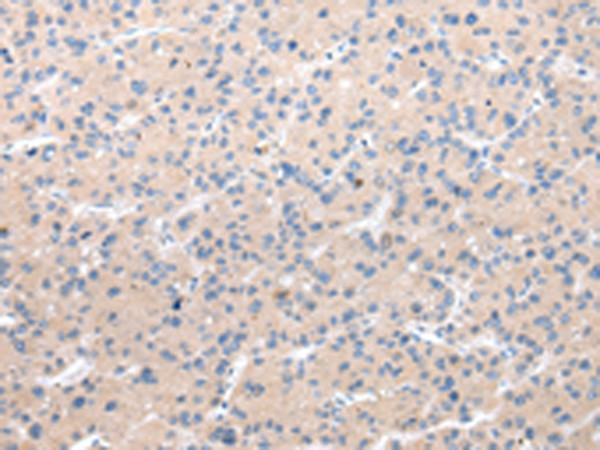CHRM5 Antibody in Immunohistochemistry (Paraffin) (IHC (P))