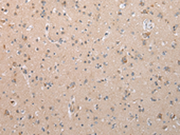 COL15A1 Antibody in Immunohistochemistry (Paraffin) (IHC (P))