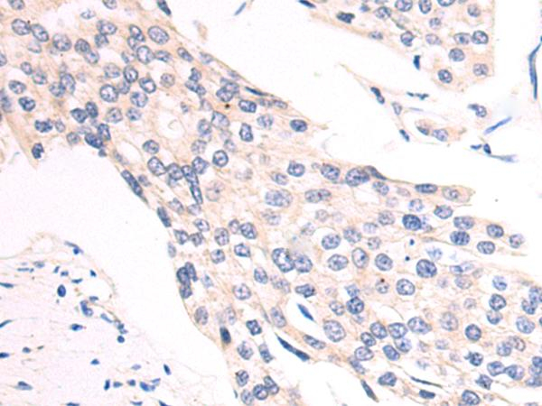 SLC2A6 Antibody in Immunohistochemistry (Paraffin) (IHC (P))