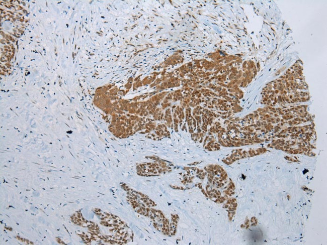 NDUFB2 Antibody in Immunohistochemistry (Paraffin) (IHC (P))