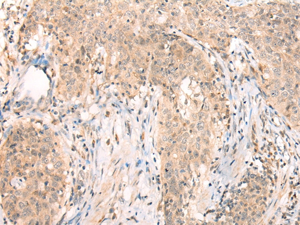 APCDD1 Antibody in Immunohistochemistry (Paraffin) (IHC (P))