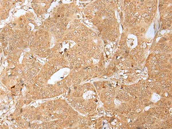 PEG3 Antibody in Immunohistochemistry (Paraffin) (IHC (P))