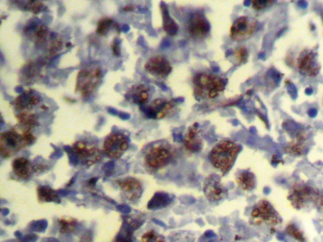 REC8 Antibody in Immunohistochemistry (Paraffin) (IHC (P))
