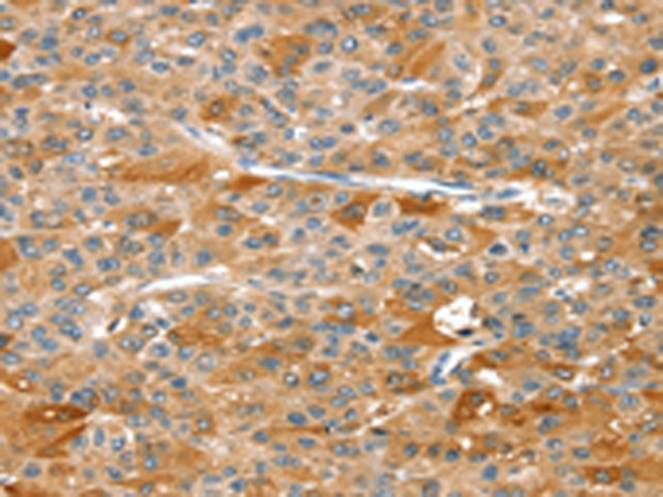 RIPK5 Antibody in Immunohistochemistry (Paraffin) (IHC (P))