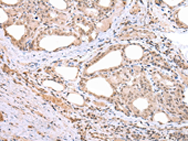 ARL17A Antibody in Immunohistochemistry (Paraffin) (IHC (P))