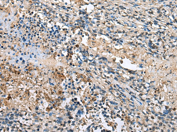 IFLTD1 Antibody in Immunohistochemistry (Paraffin) (IHC (P))