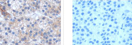 RPL35A Antibody in Immunohistochemistry (Paraffin) (IHC (P))