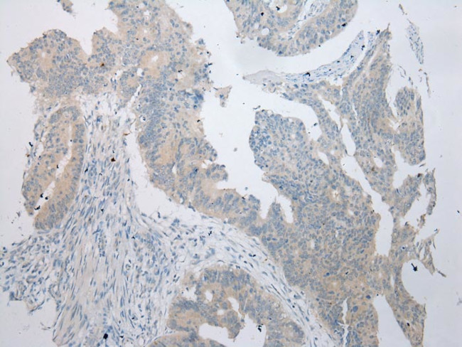 RPS15A Antibody in Immunohistochemistry (Paraffin) (IHC (P))