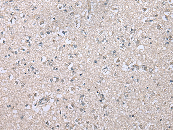 CDHR4 Antibody in Immunohistochemistry (Paraffin) (IHC (P))