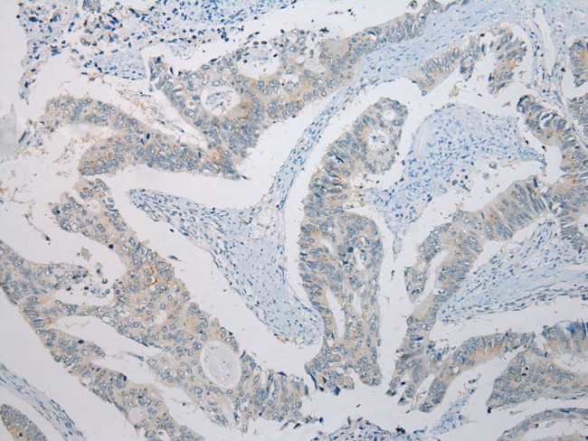 SLC35E2 Antibody in Immunohistochemistry (Paraffin) (IHC (P))