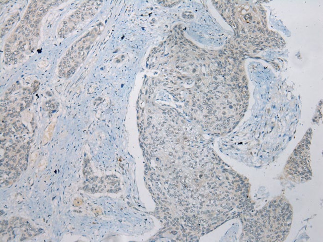 ZNRD1 Antibody in Immunohistochemistry (Paraffin) (IHC (P))